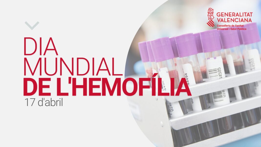 La dispensación a domicilio de la medicación a los pacientes de hemofilia mejora la adherencia al tratamiento