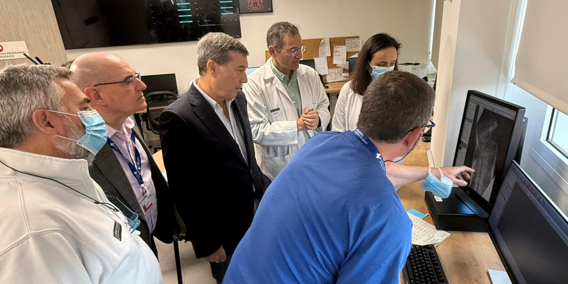 Sanidad introduce la IA en las radiografías de tórax y hueso para ayudar en el diagnóstico de patologías en Urgencias y Atención Primaria