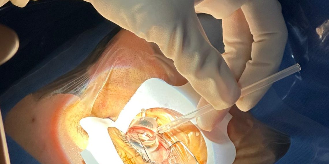 El Hospital Clínico de Valencia incorpora una nueva técnica láser para intervenciones de glaucoma