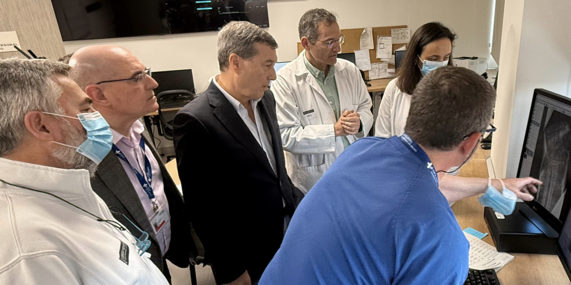 Sanidad incorpora la IA en radiografías de tórax y huesos para mejorar el diagnóstico de patologías en Urgencias y Atención Primaria