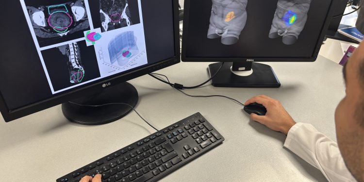 proyecto para combatir el cáncer a través de radioterapia