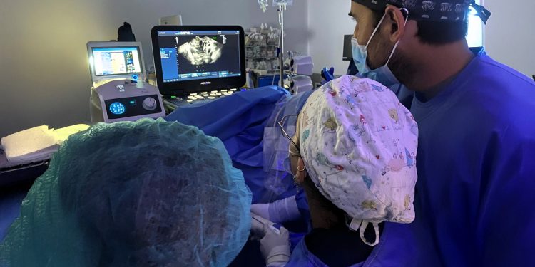 El Hospital Universitario de Vinalopó introduce una técnica sin cirugía para tratar los miomas uterinos