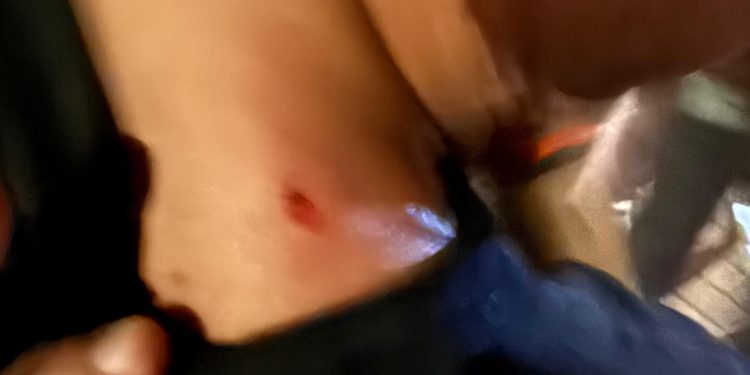 Detenido un okupa tras disparar con perdigones a jóvenes en Mareny Blau durante una discomóvil