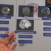 Ivace+i Innovación impulsa una nueva tecnología asistirá a los neurocirujanos con realidad aumentada e IA