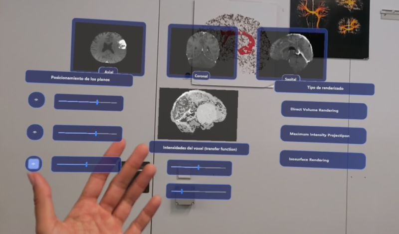 Ivace+i Innovación impulsa una nueva tecnología asistirá a los neurocirujanos con realidad aumentada e IA